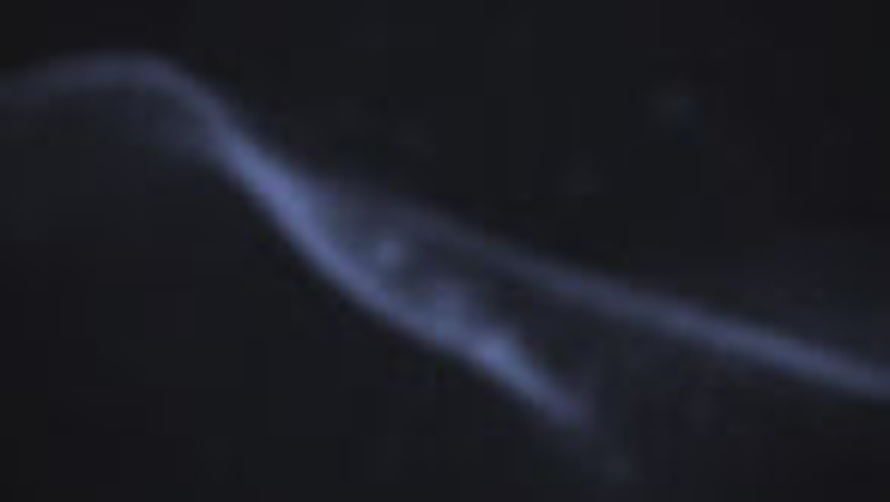 Analoge Röntgenbilder digitalisieren – Flachbettscanner in der Zahnarztpraxis